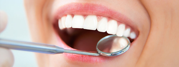 能预防龋齿的3D打印假牙问世-树脂聚合物